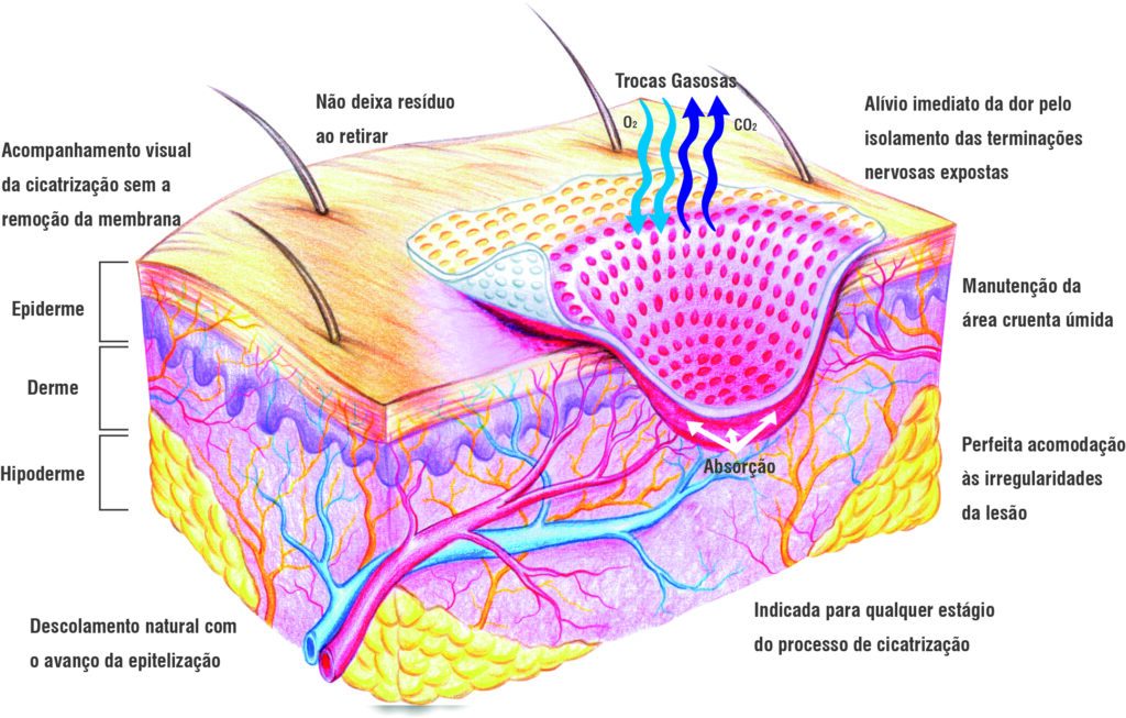 Qual a diferença entre úlcera venosa e úlcera arterial?