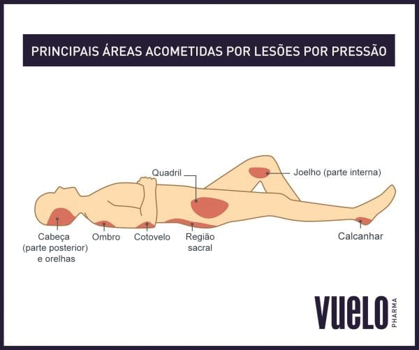 Como evitar escaras? - Vuelo Pharma