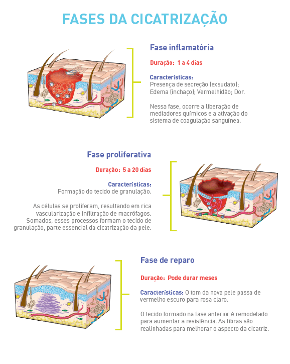 A importância da Fisioterapia para a cicatrização de feridas