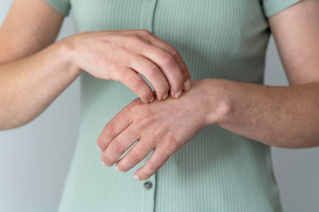 Dermatite Alérgica: Sintomas, Causas e Tratamentos Eficazes