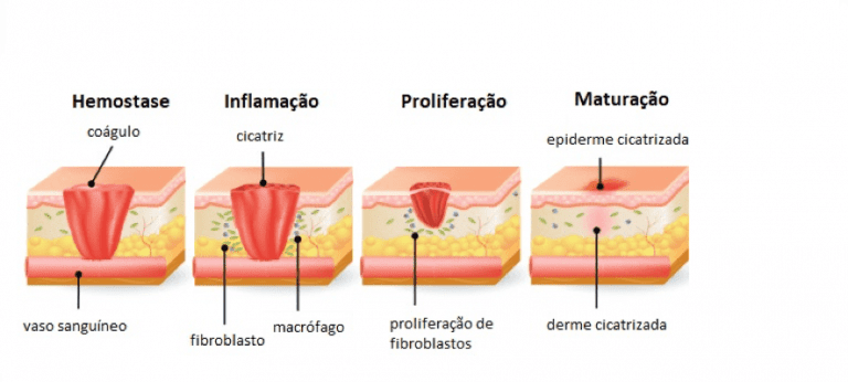 Feridas Traumáticas: O que é, causas e tratamentos