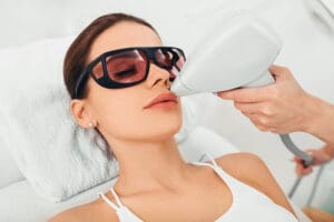 Como prevenir queimaduras na pele após depilação a laser?